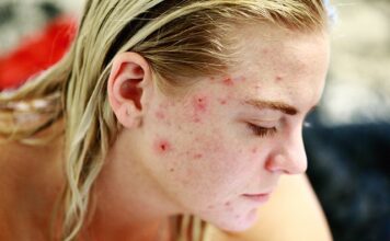 Jakie są wady refrakcji?